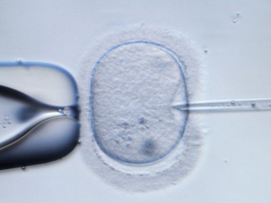 Fecondation In Vitro