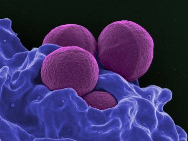 Staphylocoque doré résistant à la Méthiciline